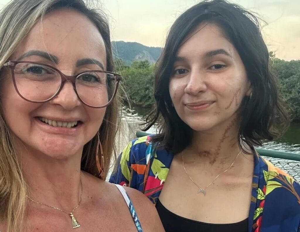 “Alana vive”: jovem que sobreviveu a ataque brutal emociona ao reaparecer após alta