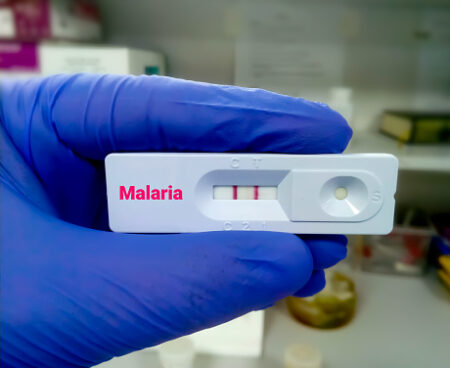 Fiocruz descarta ebola em paciente vindo de Uganda e confirma diagnóstico de malária no Rio